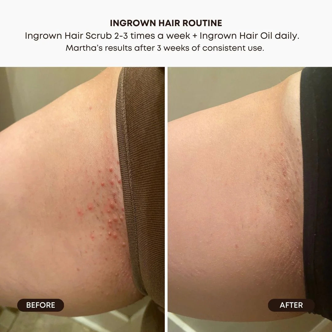 Bushbalm Watermelon Sugar Ingrown Hair Exfoliating Scrub