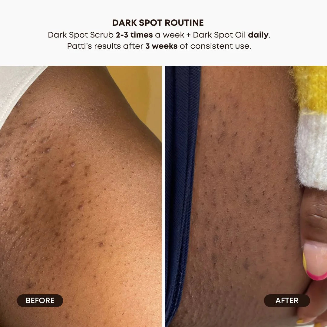Bushbalm Lavender Lemon Dark Spot Ingrown Hair Oil
