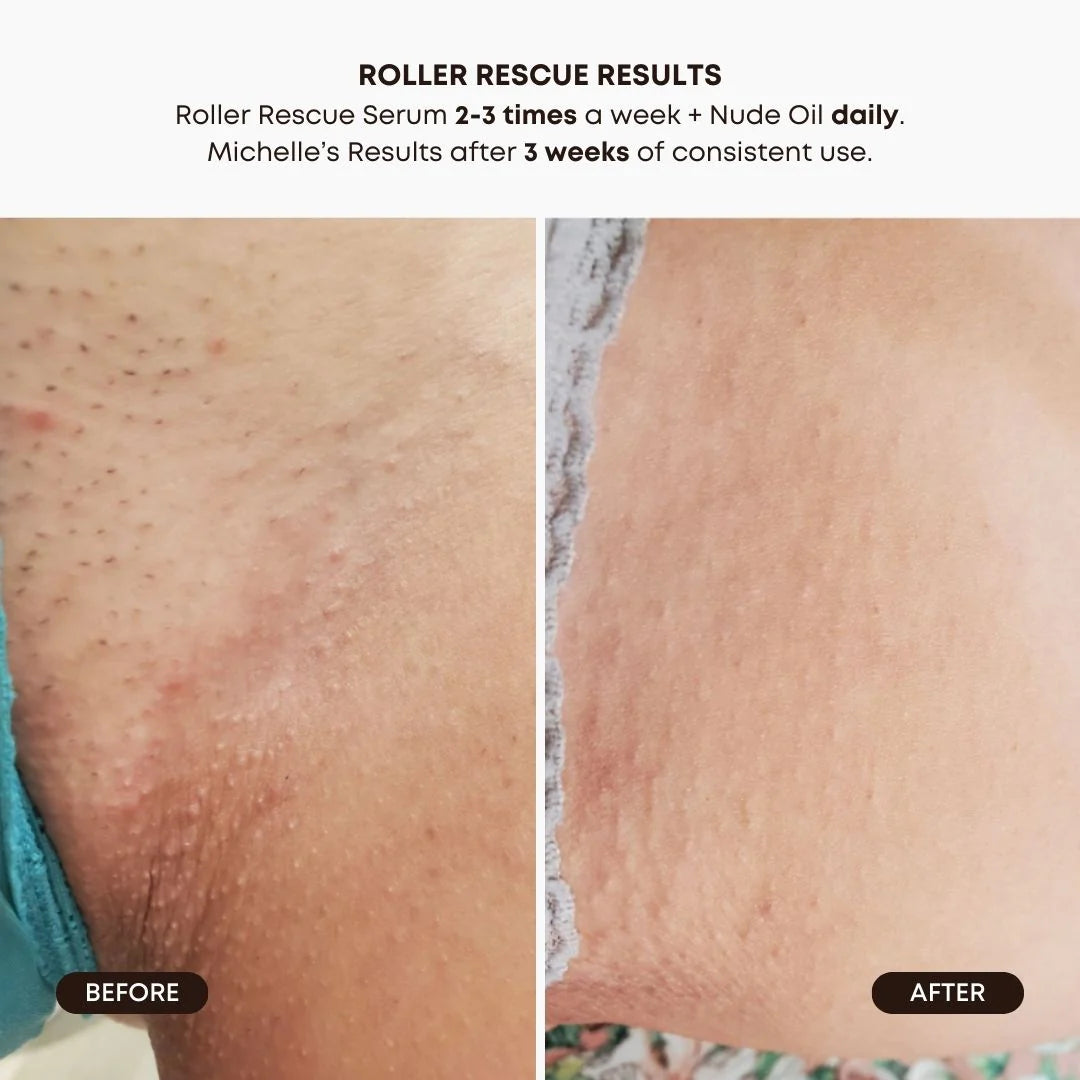 Bushbalm Roller Rescue Soothing Serum