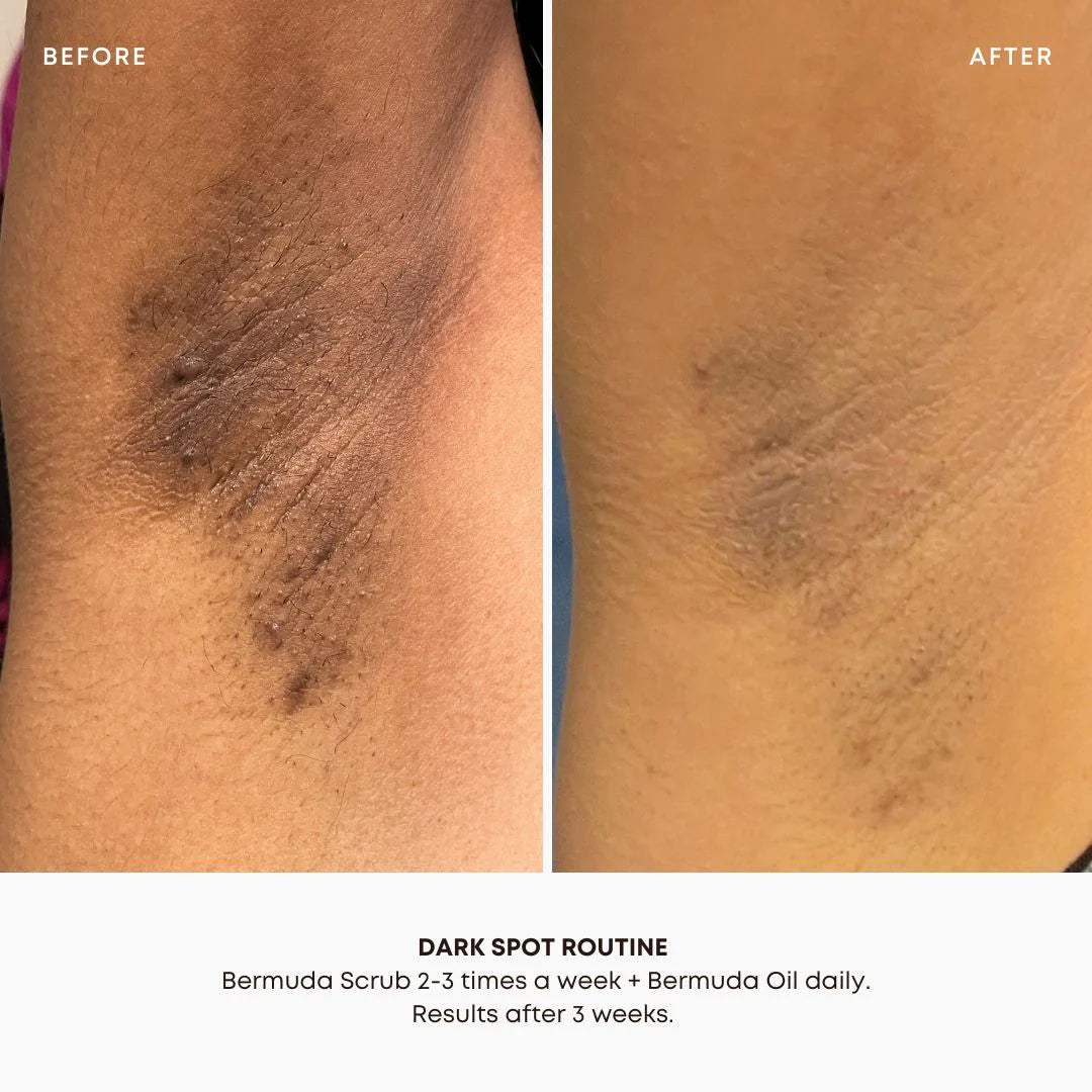 Bushbalm Bermuda Dark Spot Oil