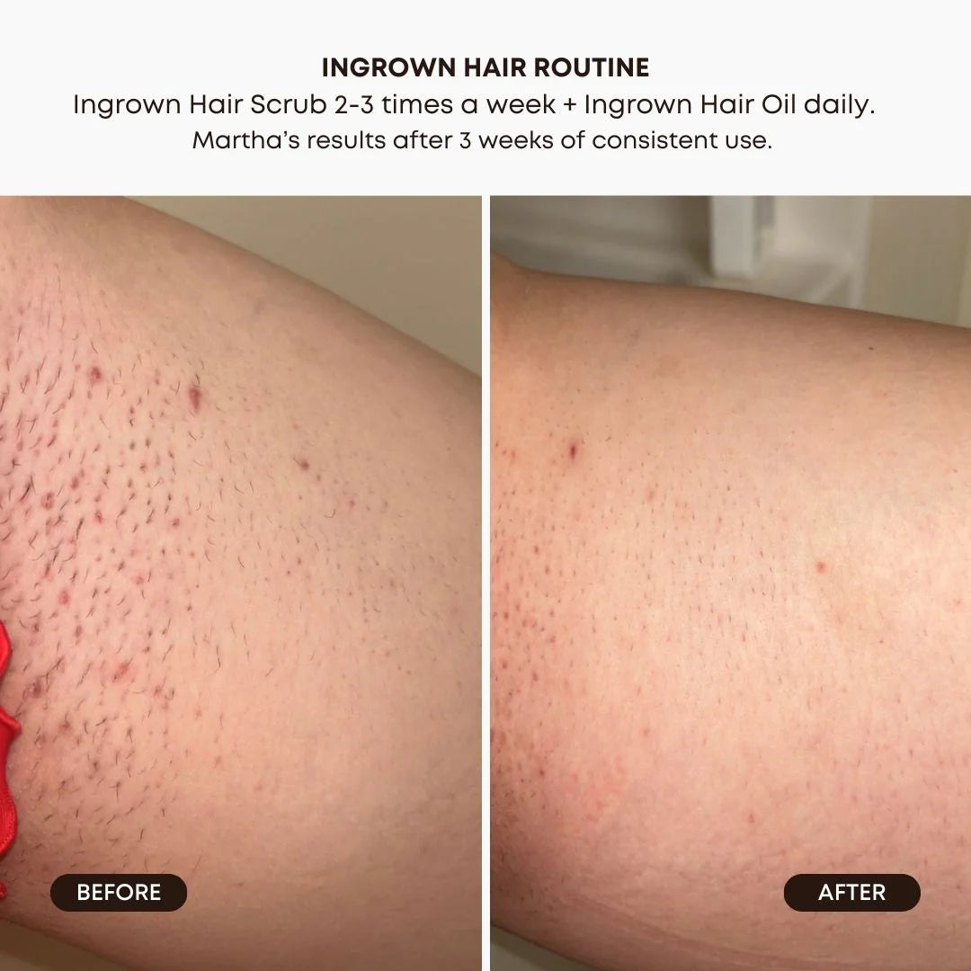 Bushbalm Watermelon Sugar Ingrown Hair Exfoliating Scrub