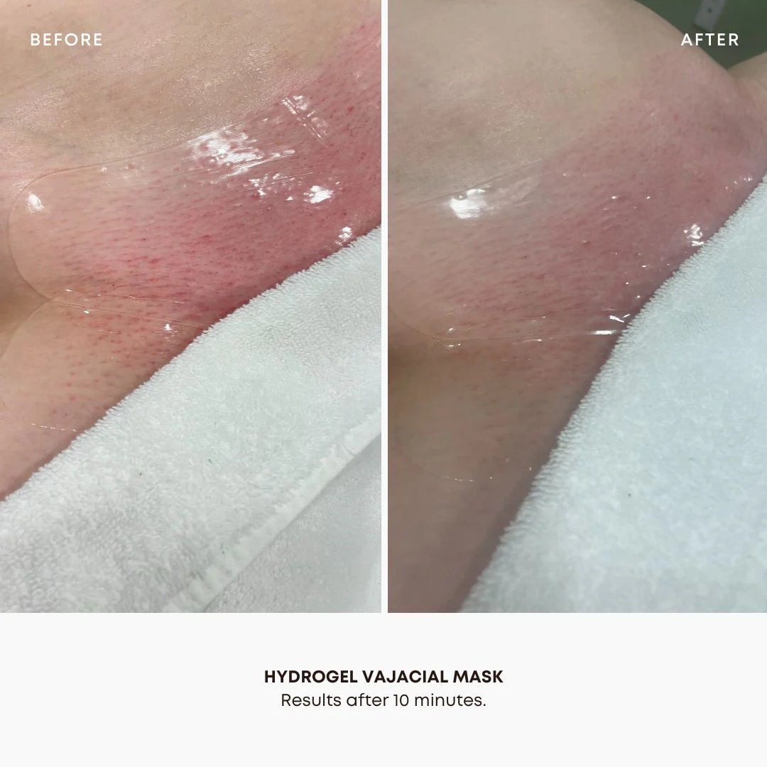 Bushbalm Hydrogel Vajacial Mask Set